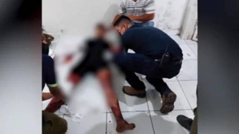 pitbul ataca a su dueño
